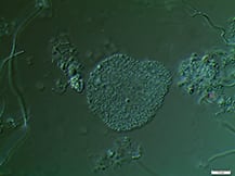 04EM-Activated sludge floc microscopic picture(alternative-2)