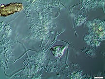 04EM-Activated sludge microscopic picture  (alternative-1)